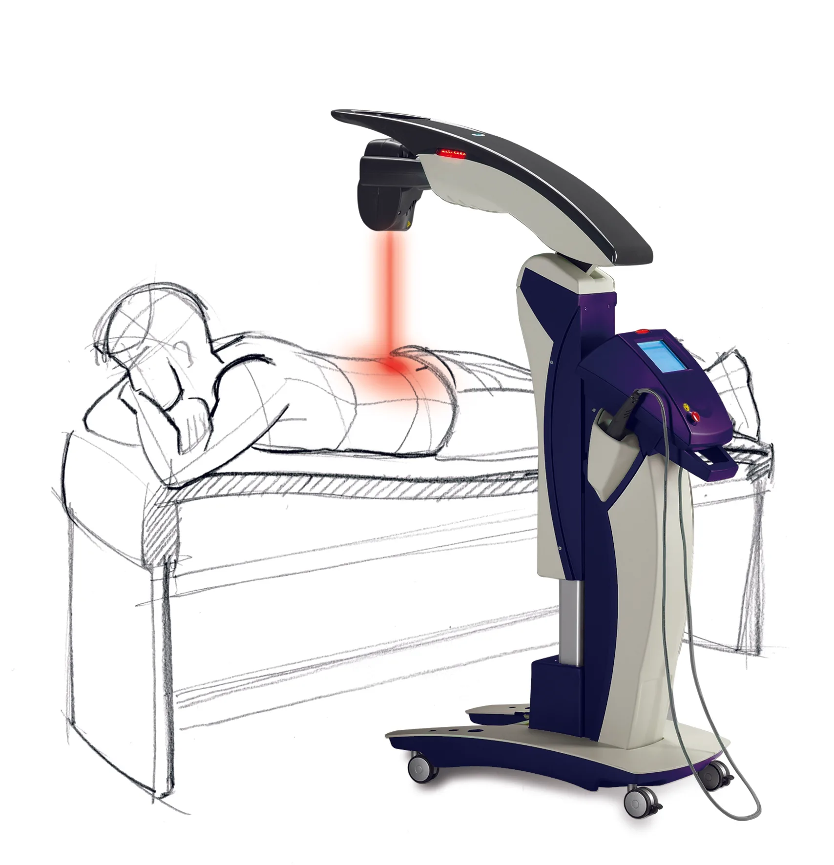 Laser Therapy at DeSalvo Chiropractic in Novato