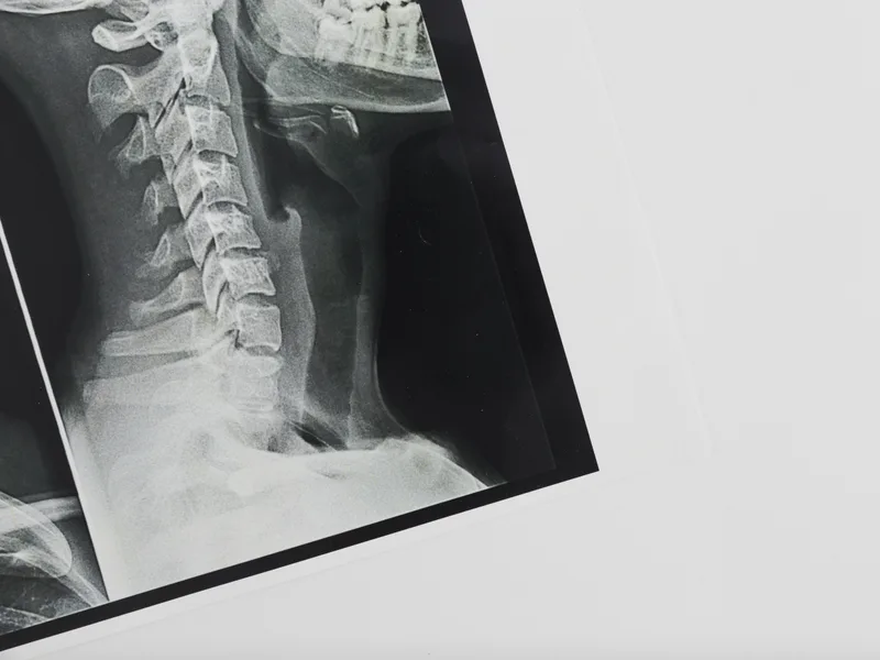 X-Rays at DeSalvo Chiropractic in Novato