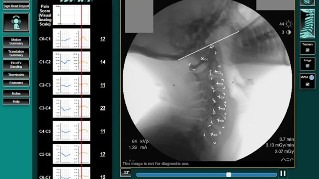 Why MRI and X-Rays Miss Ligament Injuries (And What VMA Reveals)